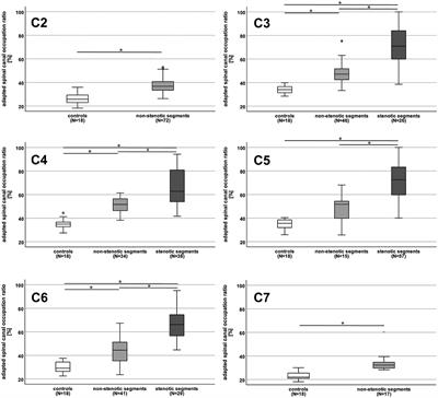 Increased cranio-caudal spinal cord oscillations are the cardinal pathophysiological change in degenerative cervical myelopathy